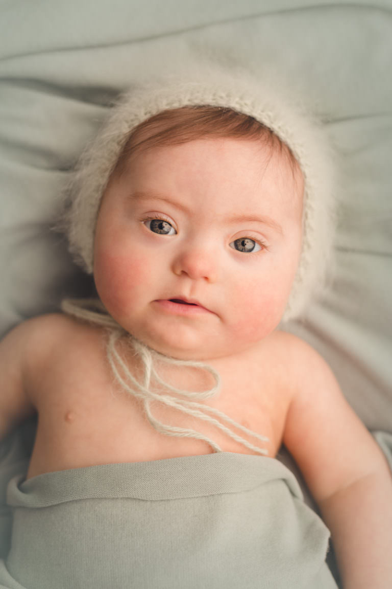 Scarlett Adele, Showing Us the “Up” in Down Syndrome