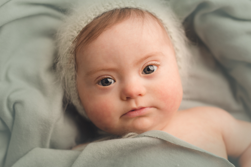 photography session of baby with down syndrome