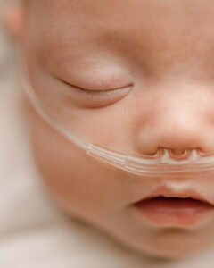 newborn photos when baby is on oxygen